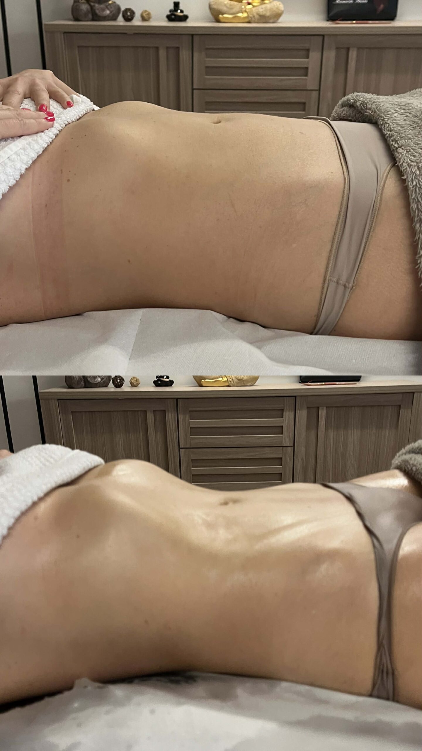 Lymphomodelage drainga lymphatique marennes charente maritime