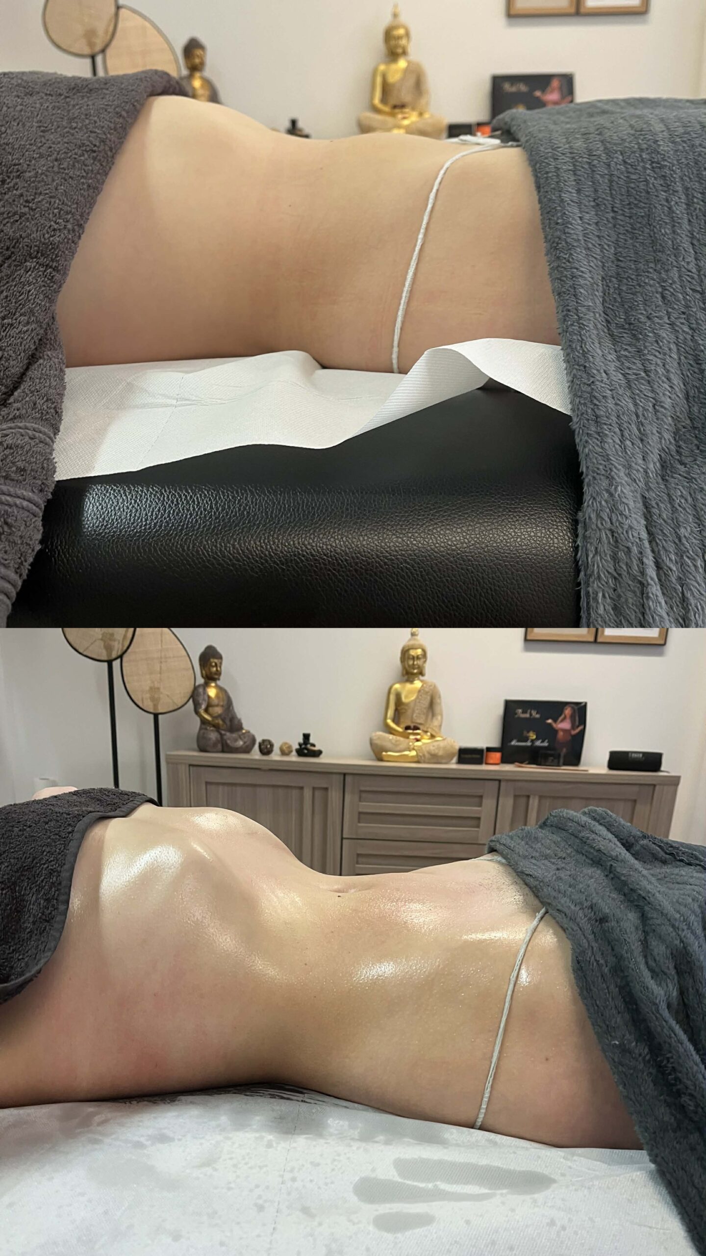 Lymphomodelage drainga lymphatique marennes charente maritime