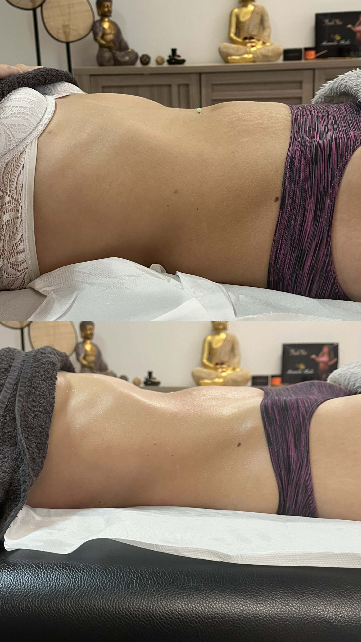 Lymphomodelage drainga lymphatique marennes charente maritime