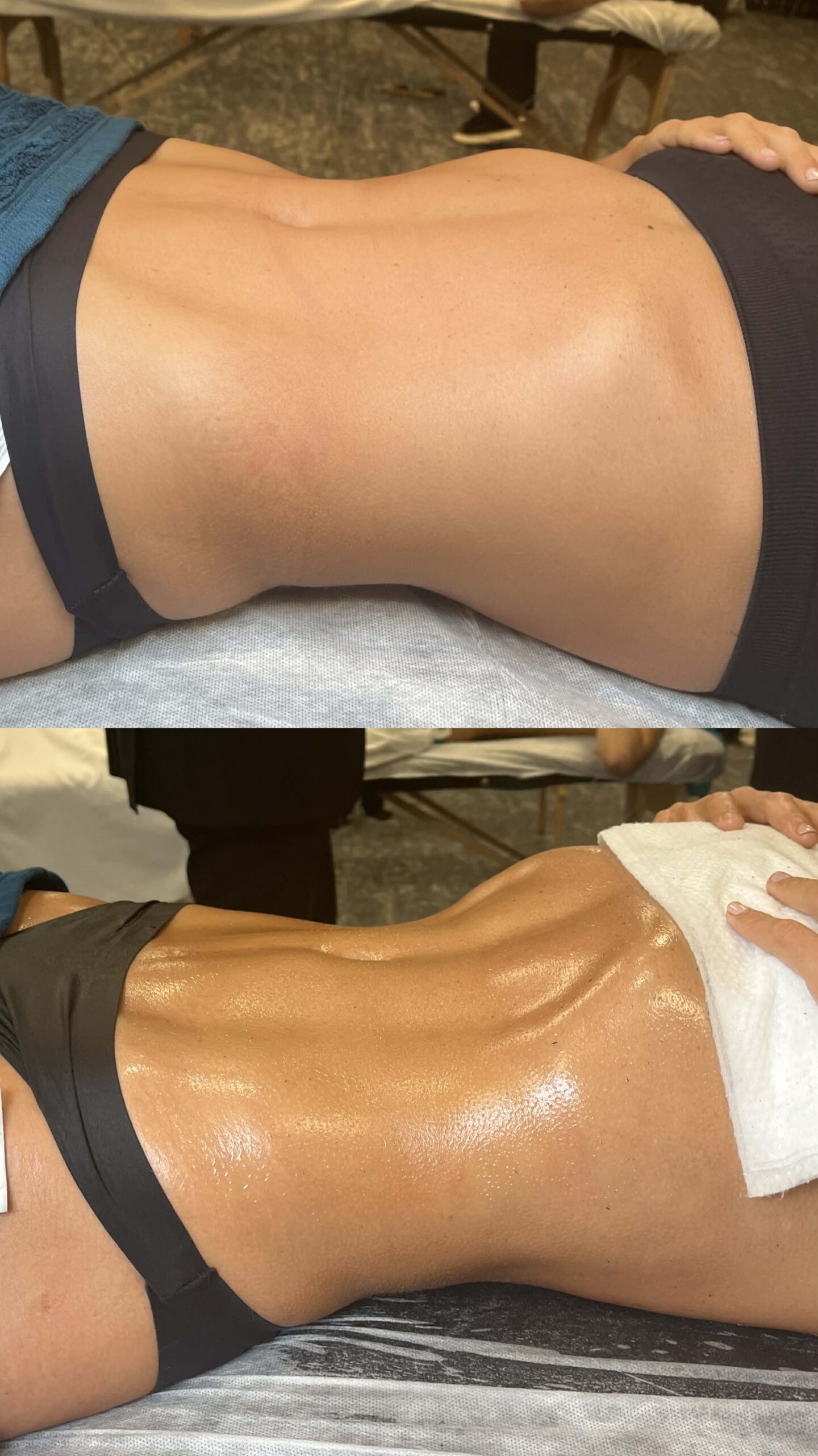 Lymphomodelage drainga lymphatique marennes charente maritime