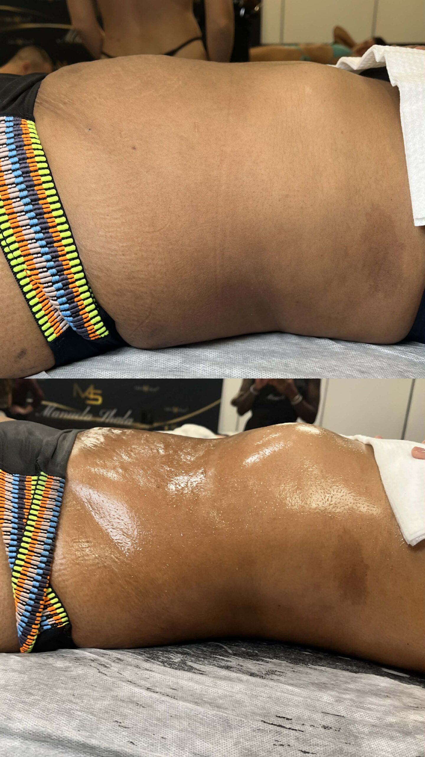 Lymphomodelage drainga lymphatique marennes charente maritime