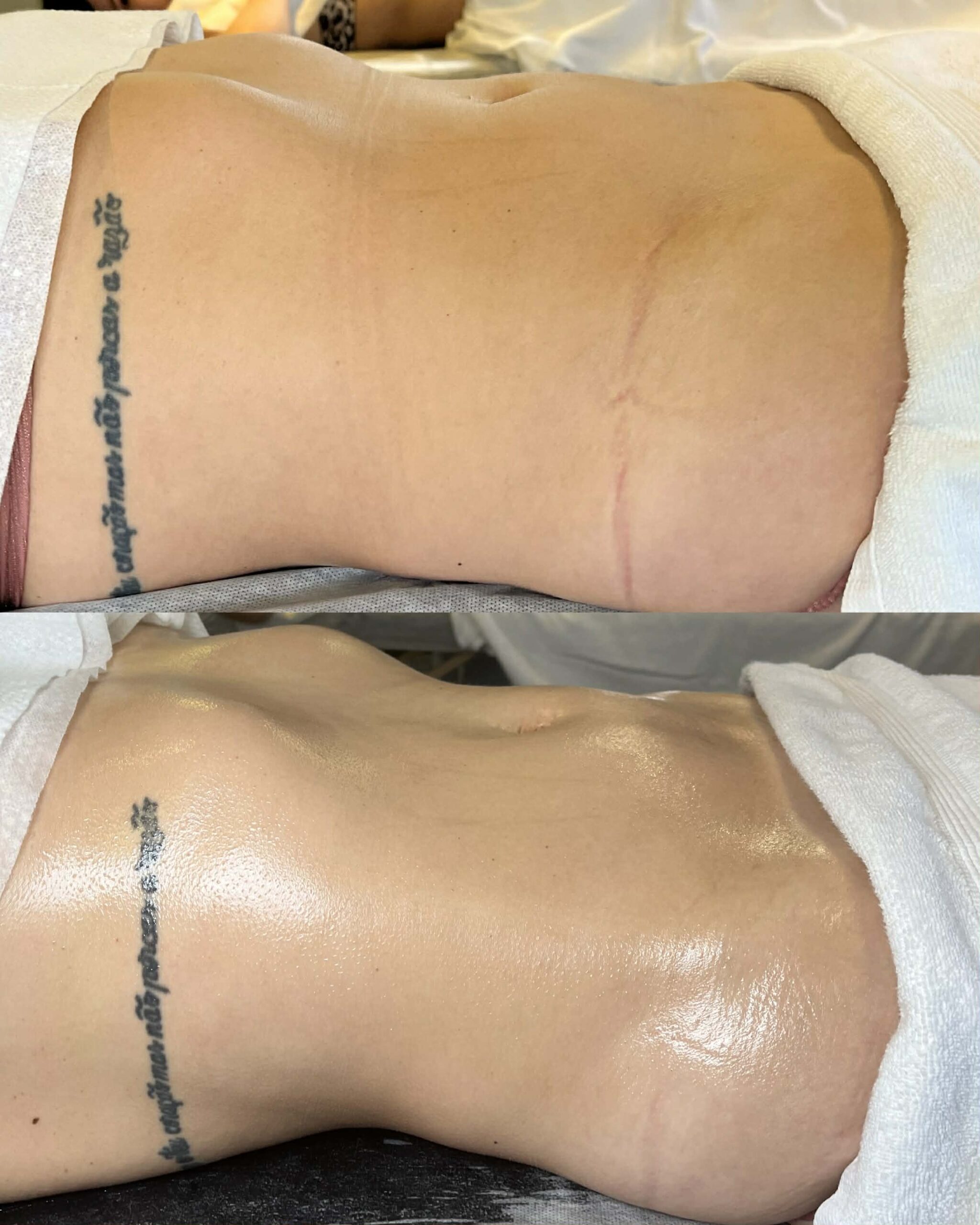 Lymphomodelage drainga lymphatique marennes charente maritime